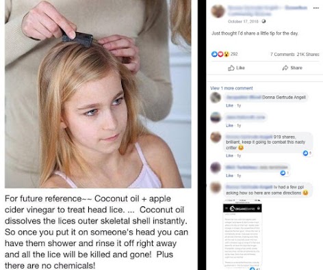 Coconut oil and apple cider vinegar are not proven remedies for lice -  Australian Associated Press