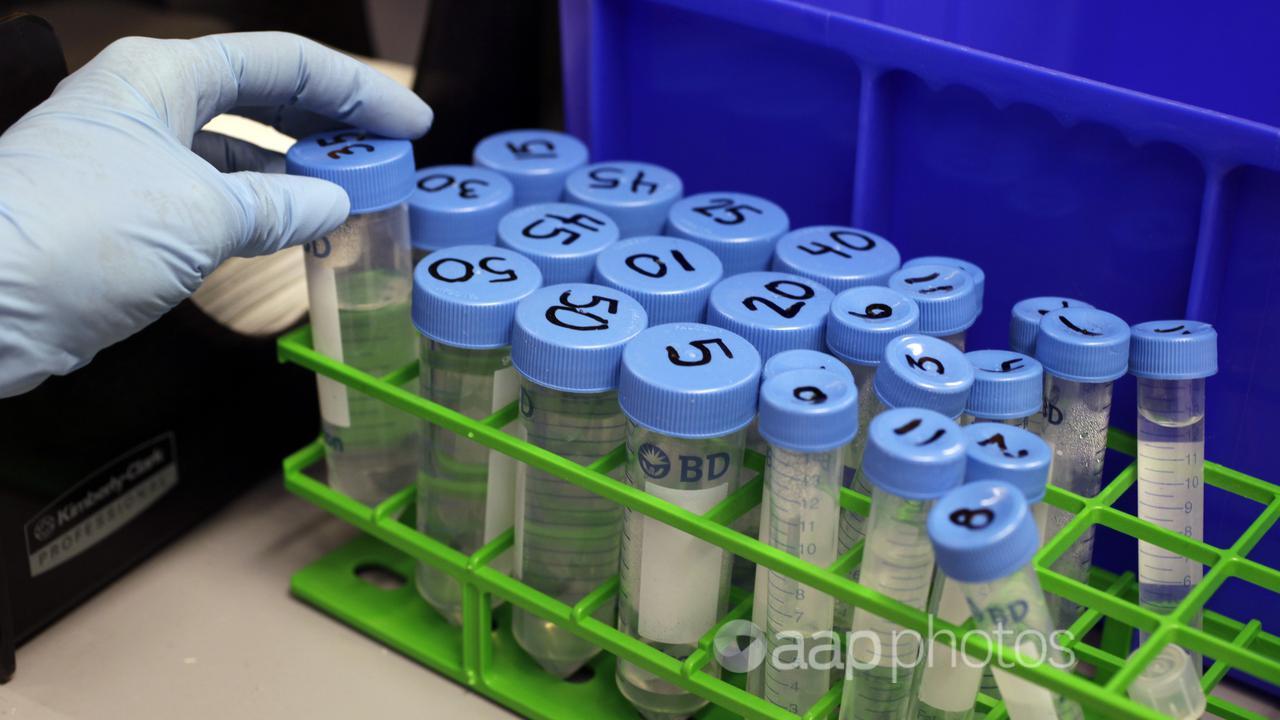 A researcher works in a stem cell lab (file image)