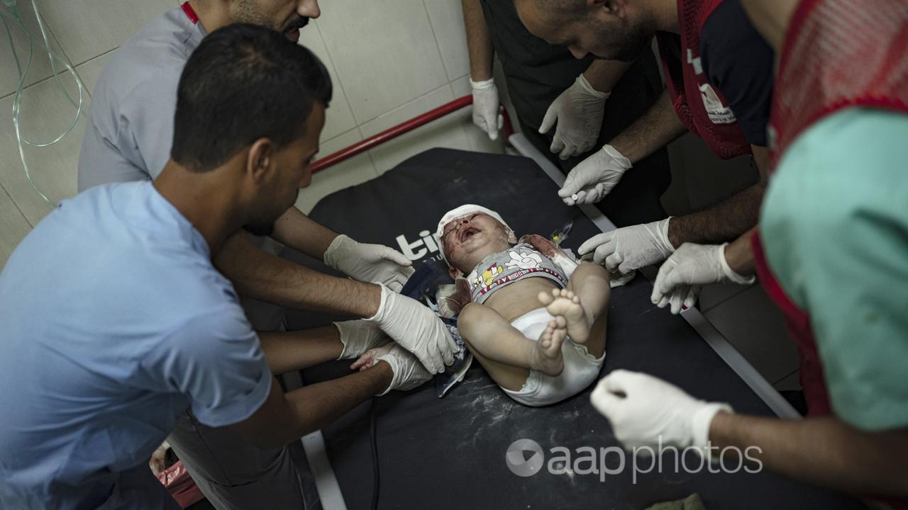 Medics treat a baby wounded in an Israeli bombardment of Gaza