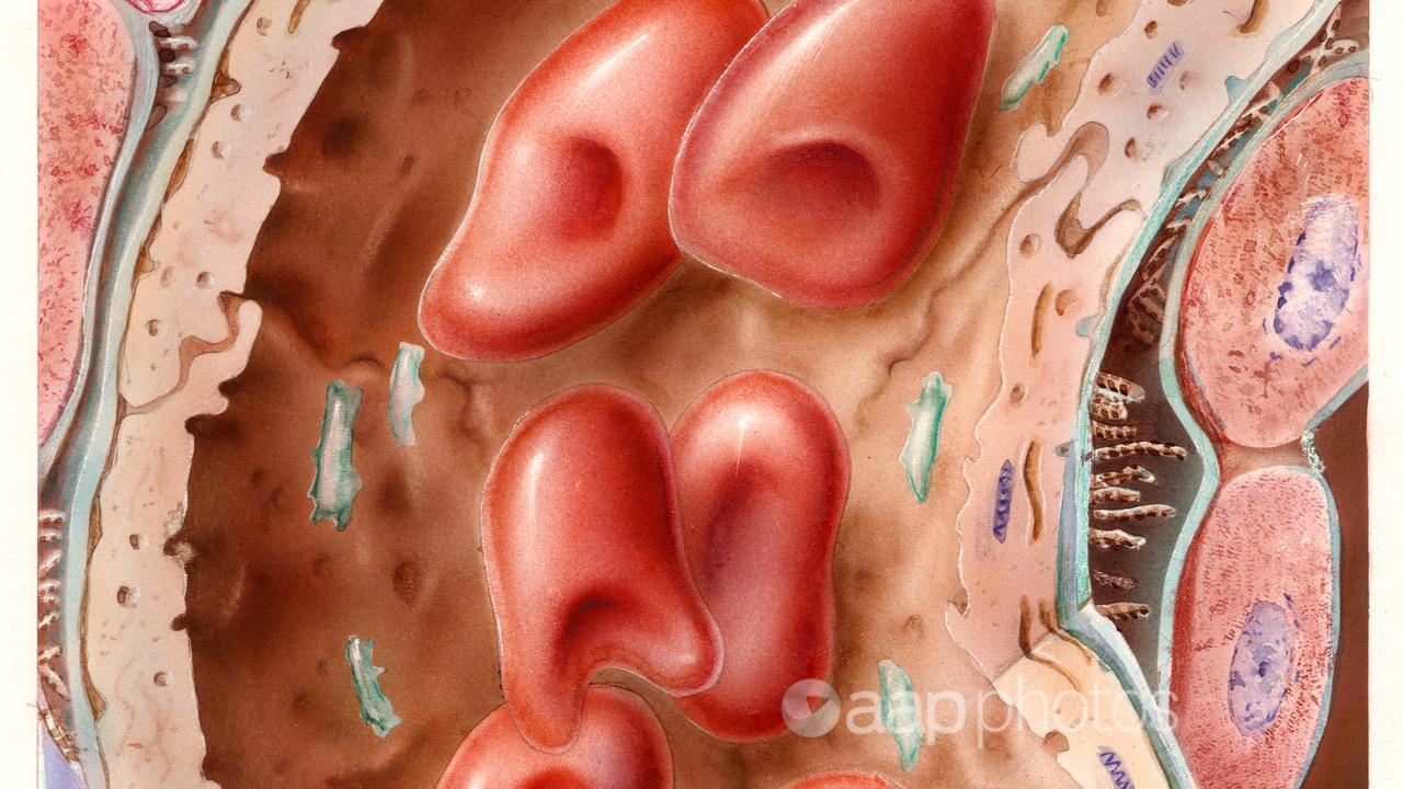 A section of a vein showing red blood cells.