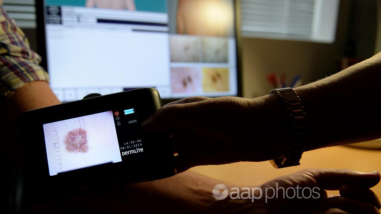 Photo of a patient being checked for skin cancers.