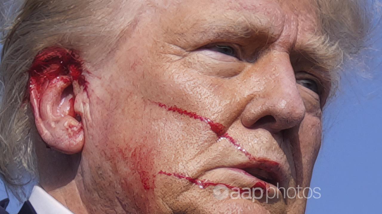 Blood coming from Trump's ear in the moments after the shooting