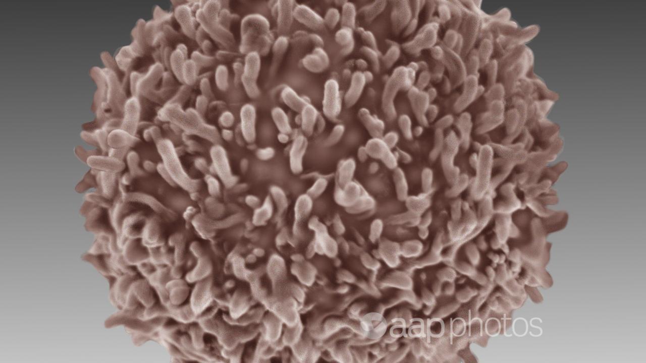 Cancer tumour cell.