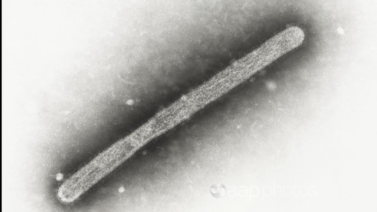 An electron microscope image showing an avian influenza A H5N1 virion.