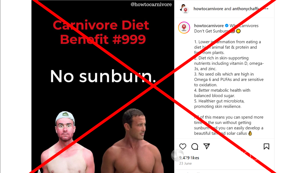 Carnivore diet does not prevent sunburn, despite claims