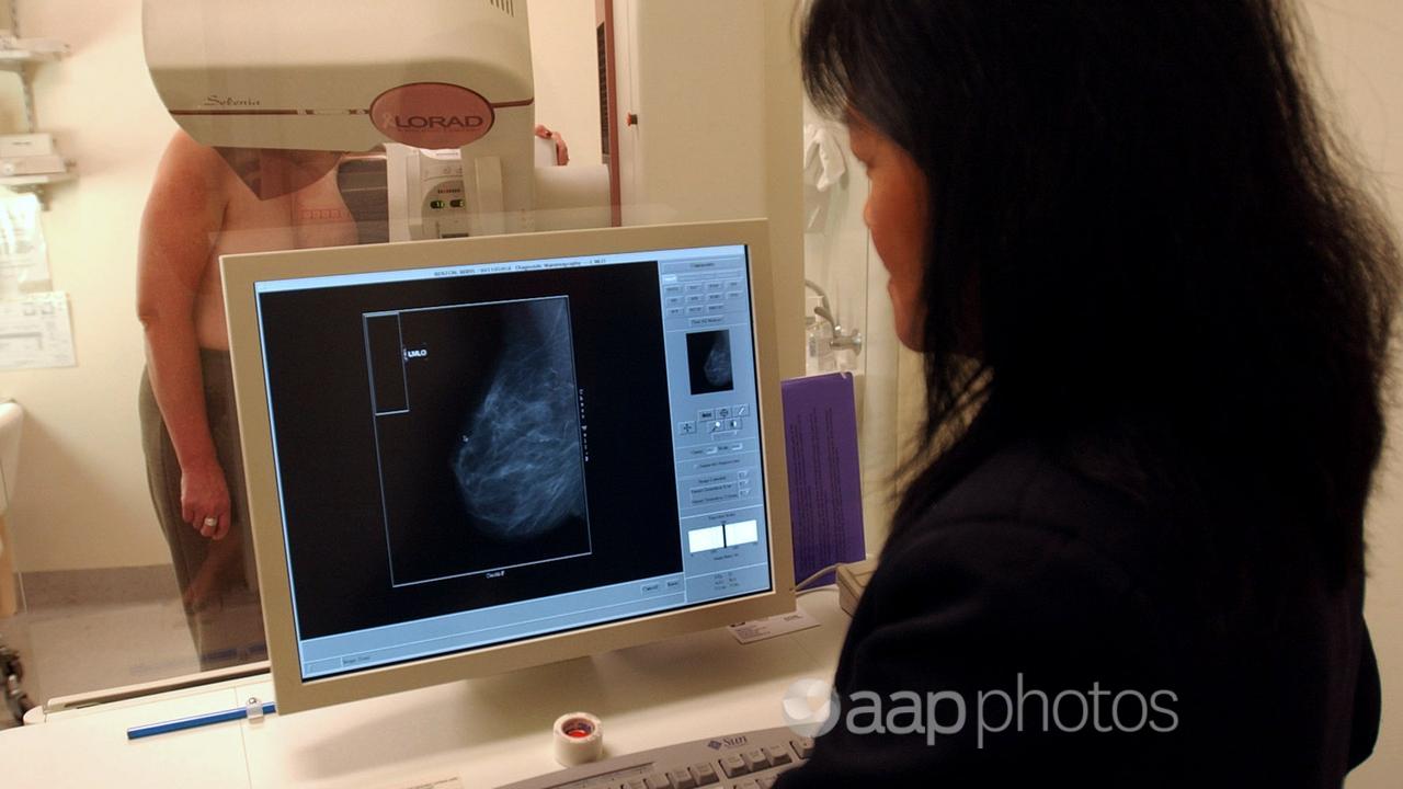 A radiographer performs a mammogram on patient (file image)