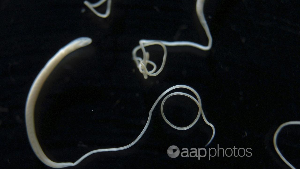 Whipworms viewed under a microscope.