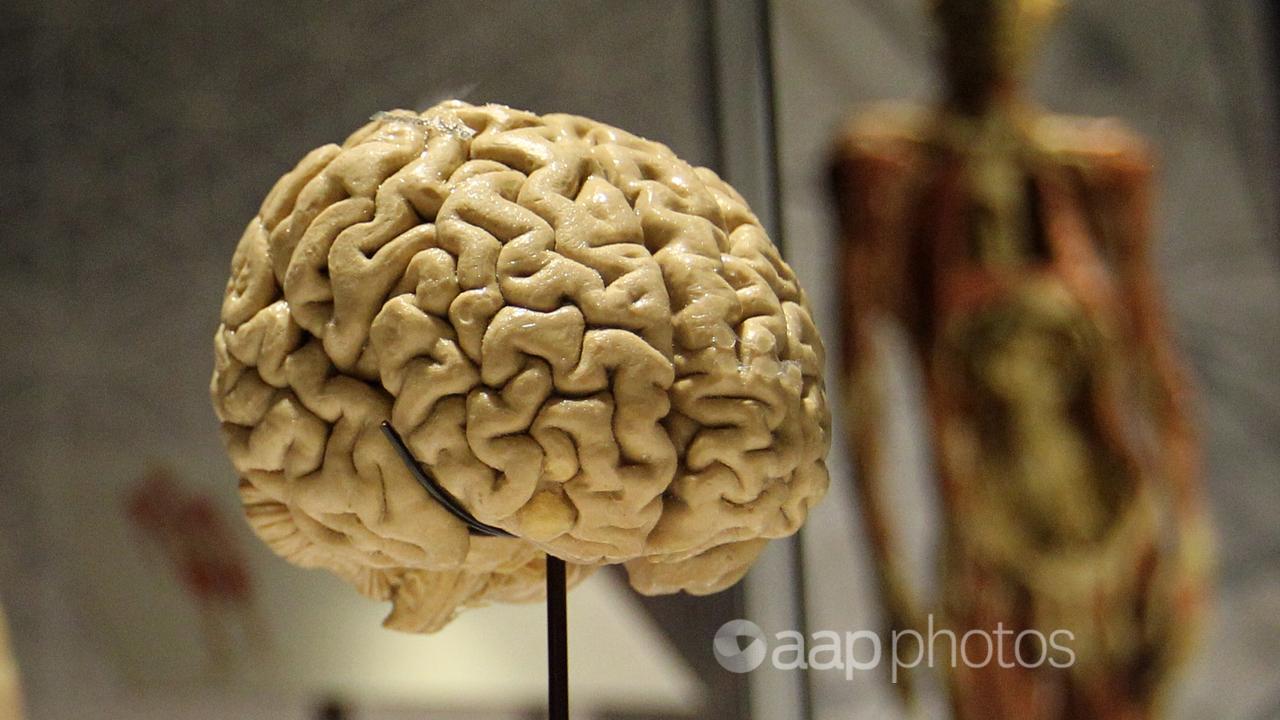 A human brain at Real Bodies The Exhibition in Sydney,