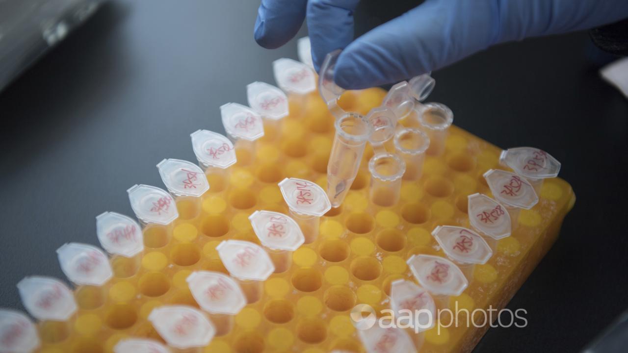 Genetic testing on eggs.